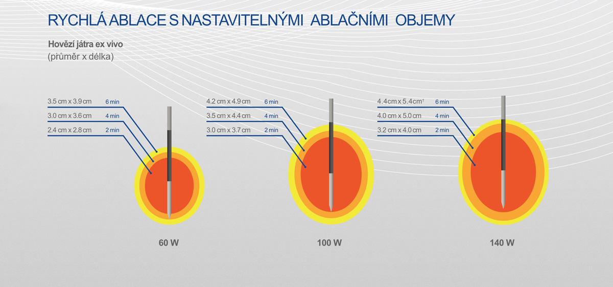 Ablační objemy - popis