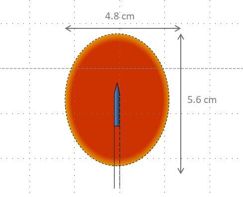 NanoKnife